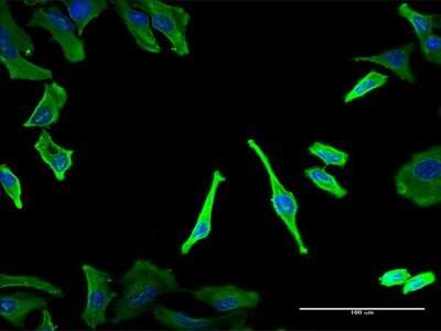 Immunocytochemistry/ Immunofluorescence: Tubulin alpha-1B Antibody (2E8) [H00010376-M12]
