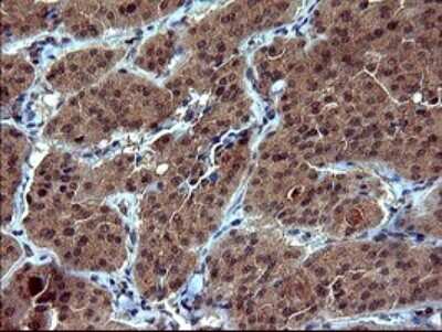 Immunohistochemistry: Tubulin alpha-1B Antibody (OTI3G3) [NBP2-46243]