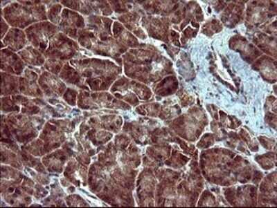 Immunohistochemistry: Tubulin alpha-1B Antibody (OTI3G3) - Azide and BSA Free [NBP2-74703]