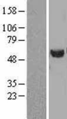 Western Blot: Tubulin alpha-1B Overexpression Lysate [NBL1-17428]