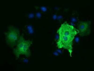 Immunocytochemistry/ Immunofluorescence: Tubulin alpha-3E Antibody (OTI2A8) - Azide and BSA Free [NBP2-74704]