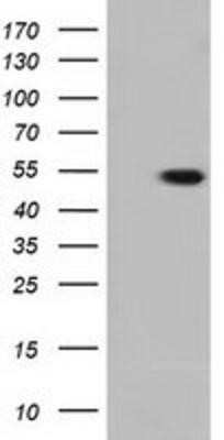 Western Blot: Tubulin alpha-3E Antibody (OTI2A8)Azide and BSA Free [NBP2-74704]
