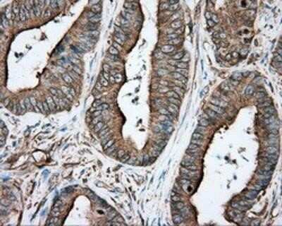 Immunohistochemistry: Tubulin alpha-8 Antibody (OTI2G6) - Azide and BSA Free [NBP2-74709]
