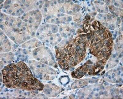 Immunohistochemistry: Tubulin alpha-8 Antibody (OTI2G6) - Azide and BSA Free [NBP2-74709]
