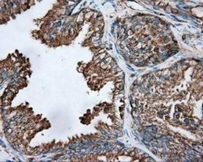 Immunohistochemistry: Tubulin alpha-8 Antibody (OTI2G6) - Azide and BSA Free [NBP2-74709]