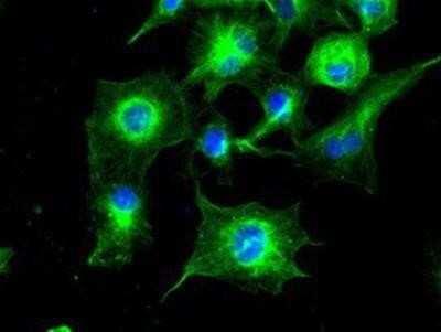Immunocytochemistry/ Immunofluorescence: Tubulin alpha-8 Antibody (OTI2G6) [NBP2-02474]
