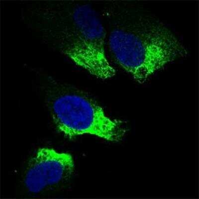 Immunocytochemistry/ Immunofluorescence: Twist-1 Antibody (10E4E6) - BSA Free [NBP2-37364]