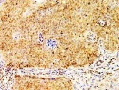 Immunohistochemistry-Paraffin: Twist-1 Antibody (10E4E6) - BSA Free [NBP2-37364]
