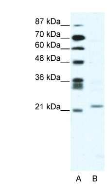 Western Blot: Twist-1 Antibody [NB120-49254]