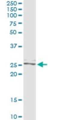 Immunoprecipitation: Twist-2 Antibody (1E2) [H00117581-M06]