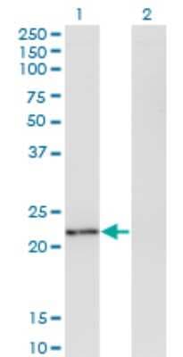 Western Blot: Twist-2 Antibody (1E2) [H00117581-M06]