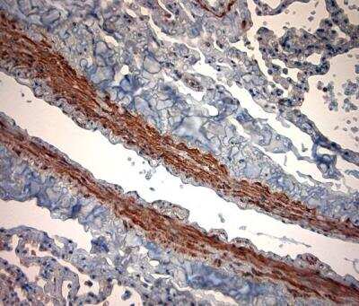 Immunohistochemistry-Paraffin: Two pore calcium channel protein 2 Antibody - Azide and BSA Free [NBP1-30670]