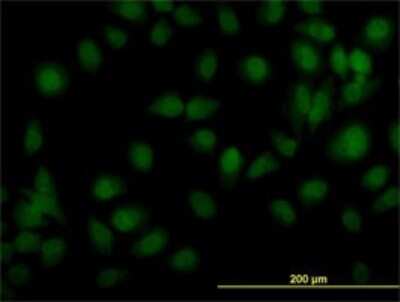 Immunocytochemistry/ Immunofluorescence: Tyk2 Antibody (5A4) [H00007297-M02]