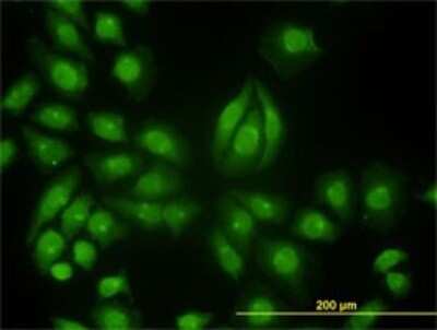 Immunocytochemistry/ Immunofluorescence: Tyk2 Antibody (6G12) [H00007297-M01]
