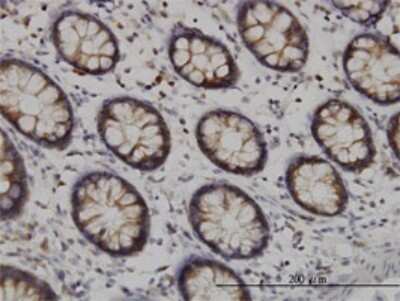 Immunohistochemistry-Paraffin: Tyk2 Antibody (6G12) [H00007297-M01]
