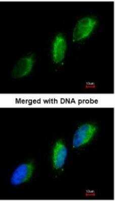 Immunocytochemistry/ Immunofluorescence: Tyk2 Antibody [NBP1-32450]