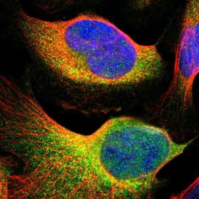 Immunocytochemistry/ Immunofluorescence: Tyk2 Antibody [NBP1-87825]