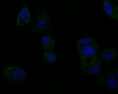 Immunocytochemistry/ Immunofluorescence: Tyk2 Antibody [NBP2-76968]