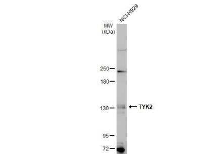 Western Blot: Tyk2 Antibody [NBP1-32450]