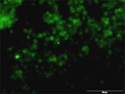 Immunocytochemistry/ Immunofluorescence: Tyrosinase Antibody (2A2-F4) [H00007299-M01]