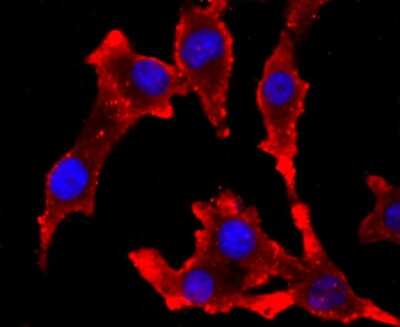 Immunocytochemistry/ Immunofluorescence: Tyrosinase Antibody (C2-B5) [NBP2-67233]