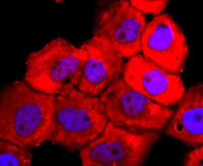 Immunocytochemistry/ Immunofluorescence: Tyrosinase Antibody (JA52-11) [NBP2-67232]