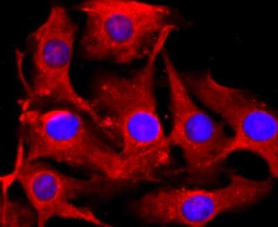 Immunocytochemistry/ Immunofluorescence: Tyrosinase Antibody (JA52-11) [NBP2-67232]