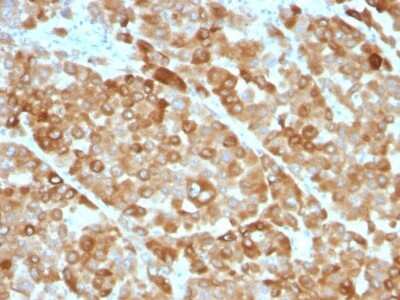 Immunohistochemistry-Paraffin: Tyrosinase Antibody (OCA1/812) [NBP2-44685]
