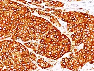 Immunohistochemistry-Paraffin: Tyrosinase Antibody (T311 + OCA1/812) - IHC-Prediluted [NBP2-48119]