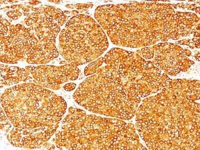 Immunohistochemistry-Paraffin: Tyrosinase Antibody (T311) - Azide and BSA Free [NBP2-33160]