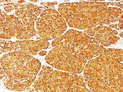 Immunohistochemistry-Paraffin: Tyrosinase Antibody (T311) [NBP2-25238]