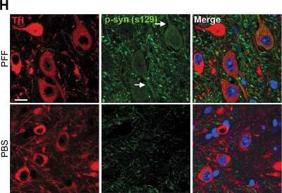 Immunocytochemistry/ Immunofluorescence: Tyrosine Hydroxylase Antibody [NB300-110]