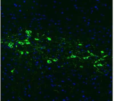 Immunohistochemistry: Tyrosine Hydroxylase Antibody (CL3049) [NBP2-46647]