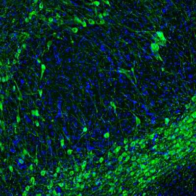 Immunocytochemistry/ Immunofluorescence: Tyrosine Hydroxylase Antibody [NBP3-05555]