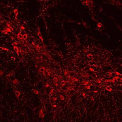 Immunohistochemistry: Tyrosine Hydroxylase Antibody [NB300-110]
