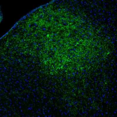 Immunohistochemistry: Tyrosine Hydroxylase Antibody [NBP2-38903]