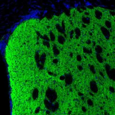 Immunohistochemistry: Tyrosine Hydroxylase Antibody [NBP2-38903]