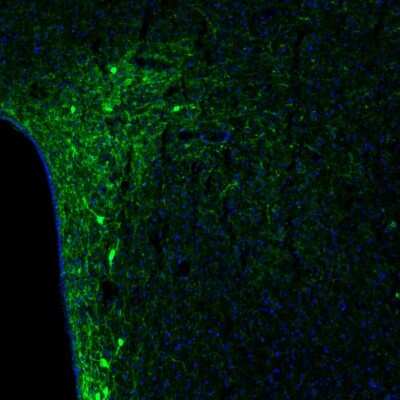 Immunohistochemistry: Tyrosine Hydroxylase Antibody [NBP2-38903]