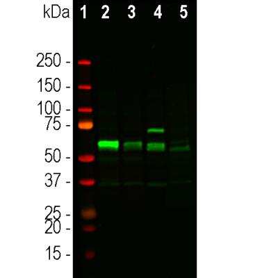 Western Blot: Tyrosine Hydroxylase Antibody [NBP3-05555]