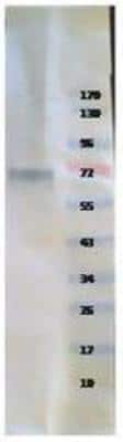 Western Blot: Recombinant Human Tyrosine Hydroxylase His Protein [NBP1-42461]