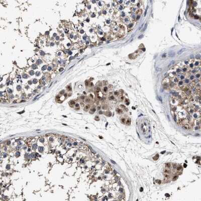 Immunohistochemistry-Paraffin: Tyrosylprotein Sulfotransferase 2/TPST2 Antibody [NBP1-86023]