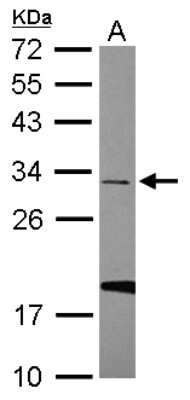 Western Blot: U11/U12-35K Antibody [NBP2-20774]
