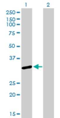 Western Blot: U1A Antibody (3F9-1F7) [H00006626-M01]