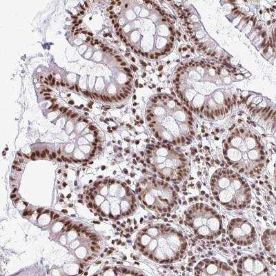 Immunohistochemistry-Paraffin: U1A Antibody [NBP2-33465]