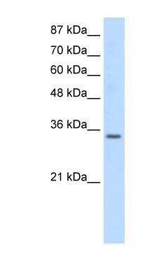 Western Blot: U1A Antibody [NBP1-80452]