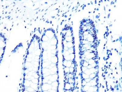 Immunohistochemistry-Paraffin: U2AF2 Antibody (8E8R9) [NBP3-16432]