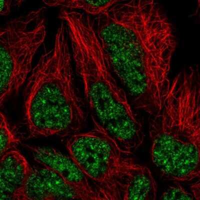 Immunocytochemistry/ Immunofluorescence: U2AF2 Antibody [NBP2-58989]