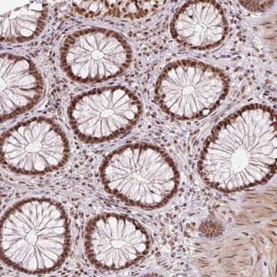 Immunohistochemistry: U2AF2 Antibody [NBP2-33397]