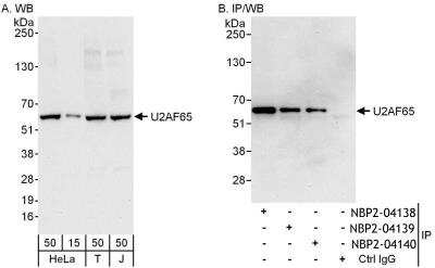 Immunoprecipitation: U2AF2 Antibody [NBP2-04140]