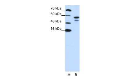 Western Blot: U2AF2 Antibody [NBP1-57251]